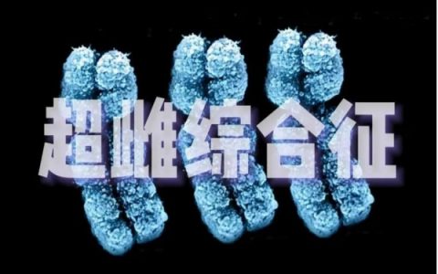 超雌综合征的长相漂亮吗 超雌综合征有什么症状表现