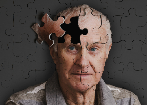阿尔茨海默症测试题分享 阿尔茨海默症的七个阶段解析